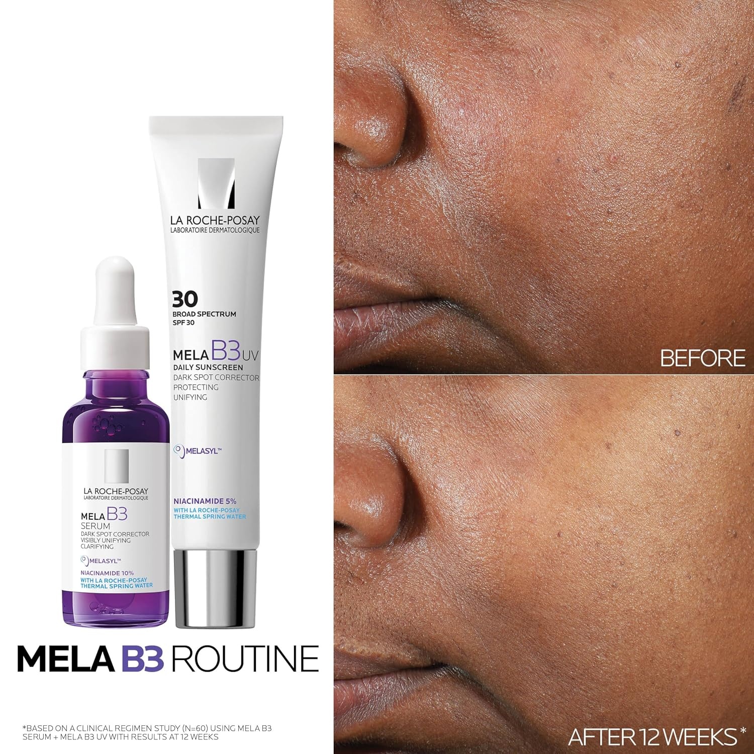 image:imageLa RochePosay Mela B3 UV Face Sunscreen SPF 30 with Niacinamide 135oz