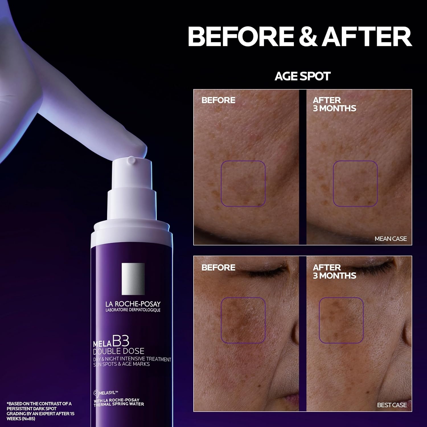 image:imageLa RochePosay Mela B3 Double Dose Dark Spot AntiAging Treatment 135oz